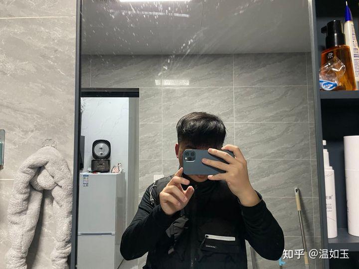 持续更新中：植发已一年，谈谈这一路上的坑！