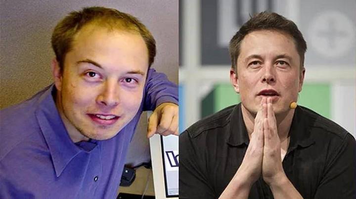 为什么秃顶的人这么多，很少有做植发的？