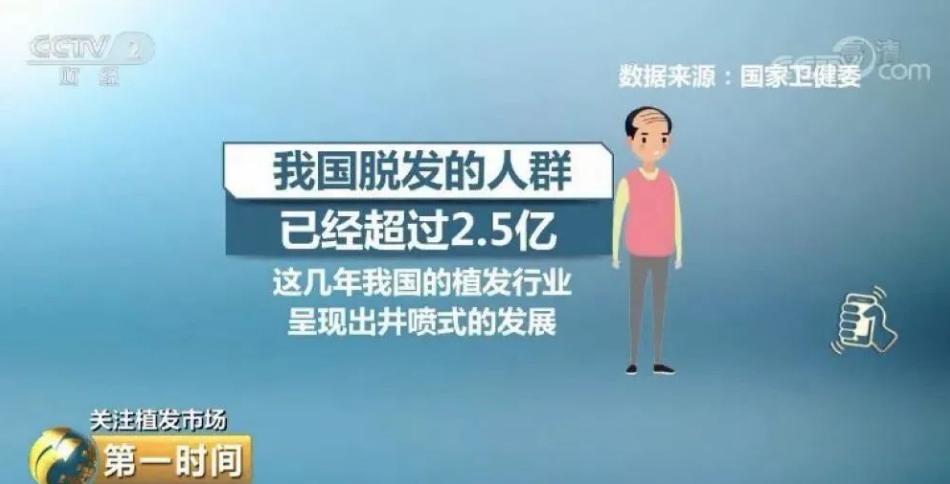 植发的技术原理和流程