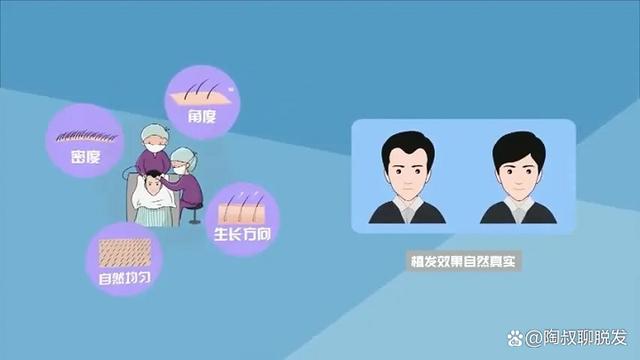 植发全过程｜原来脱发是这样治好的？