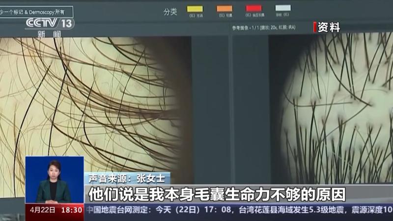 存活率成谜、维权难，植发成了赌局？央视曝光植发经济乱象