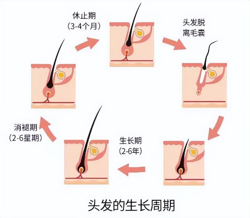失去的头发还能长回来吗？一文带你了解清楚