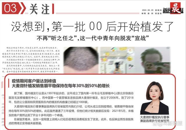 大麦微针植发崔韶芳：脱发问题日趋年轻化